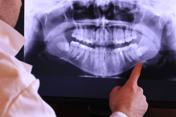 Best Mobile Emergency Dentist in Newton, TX