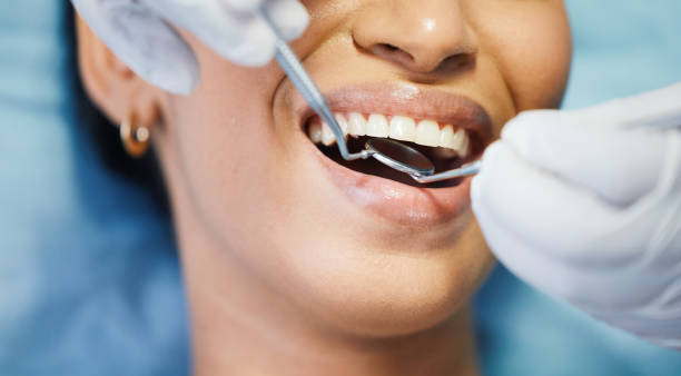 Best Broken or Cracked Tooth Emergency Dentist in Newton, TX