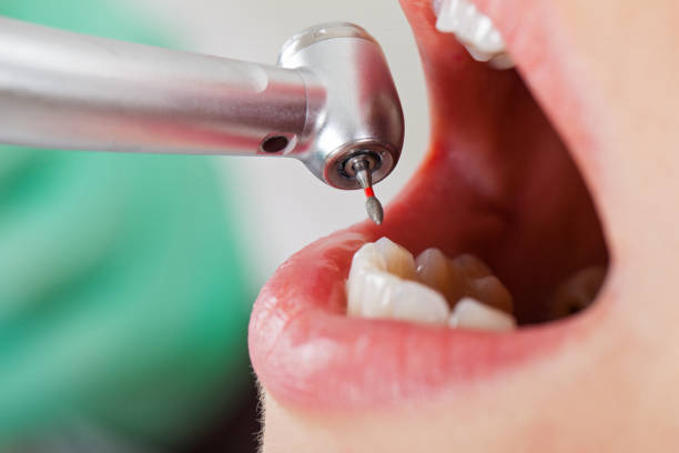 Best Emergency Dental Services for Seniors in Newton, TX